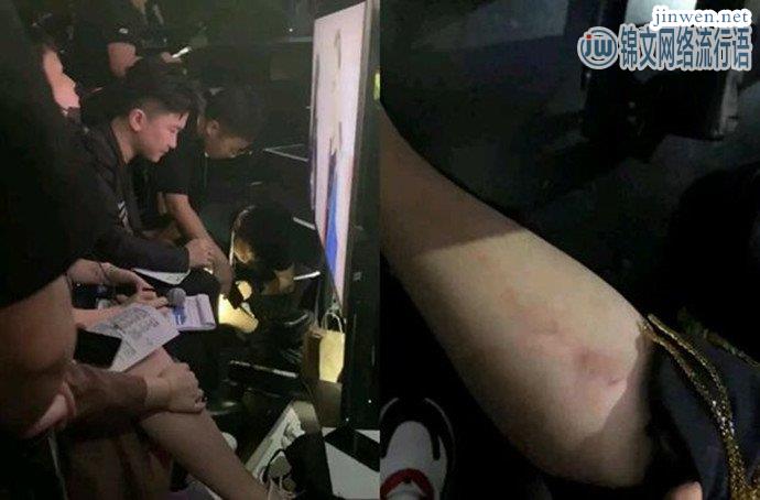 《明日之子》节目嘉宾张大大摔伤，却无人同情原因